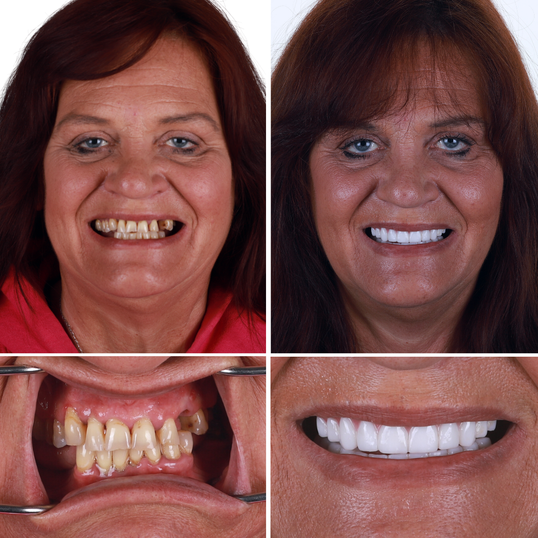 my1stchoicedentalcarecom_136855961